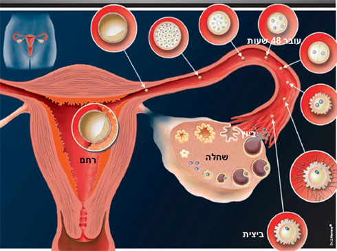 מהי הפריה חוץ גופית