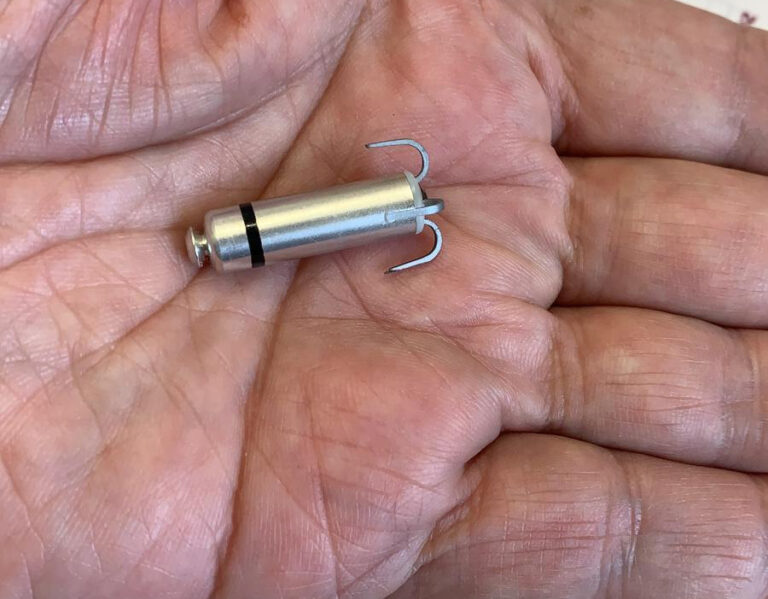 קוצב הלב הקטן ביותר בעולם הושתל לראשונה בהלל יפה