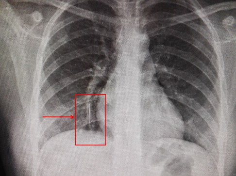 رحلة سنوية تنتهي في غرفة العمليات