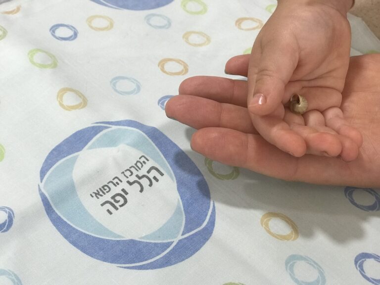 חילזון חולץ מאפו של פעוט בן שלוש