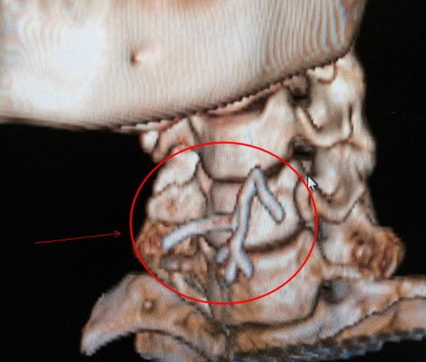 قطعة من الحلوى كانت نهايتها في المستشفى