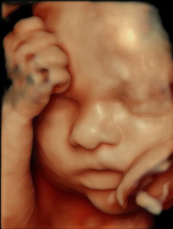 So does the baby look like mom or dad?