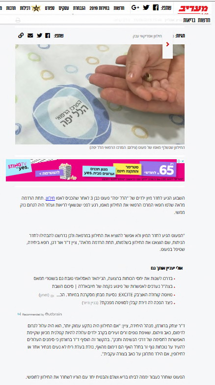 חילזון נשלף מאפו של פעוט במרכז הרפואי הלל יפה