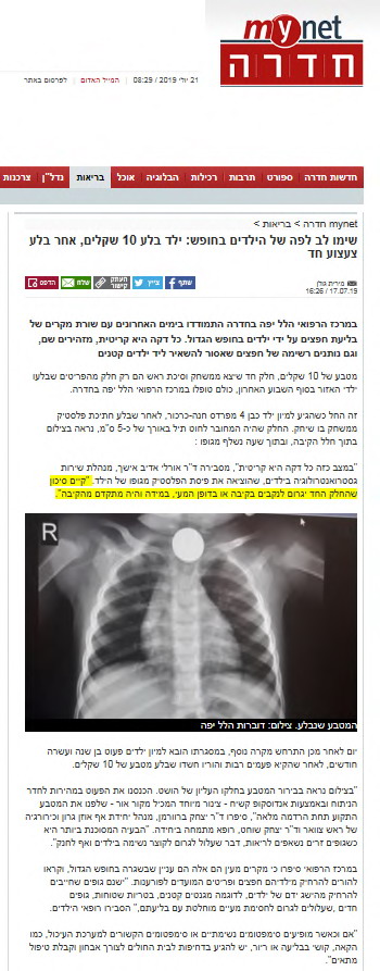 ילד בלע 10 שקלים, אחר בלע צעצוע חד