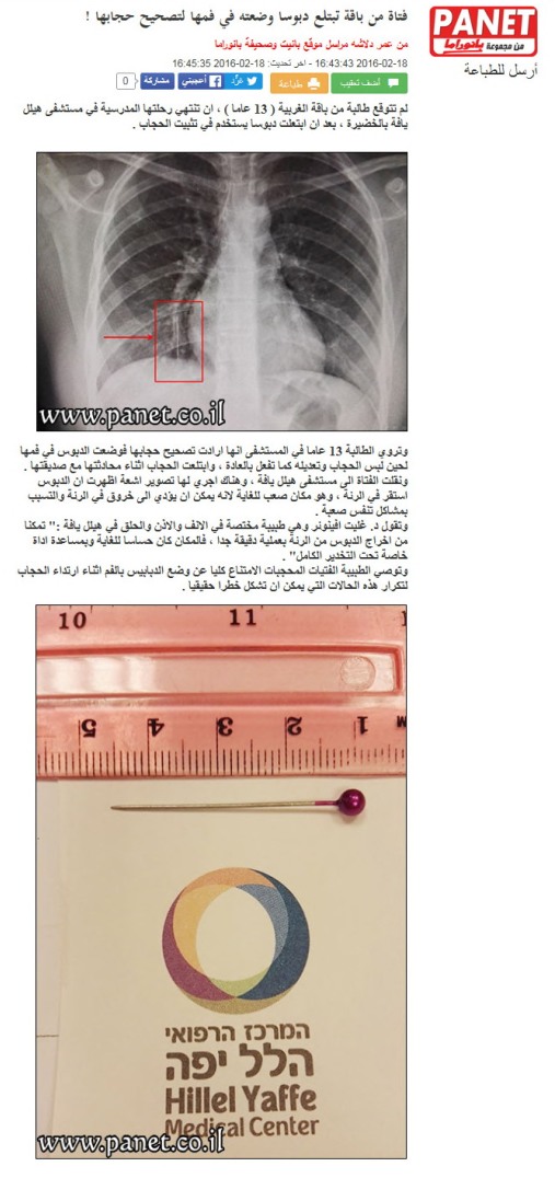 فتاة من باقة تبتلع دبوسا وضعته في فمها لتصحيح حجابها !
