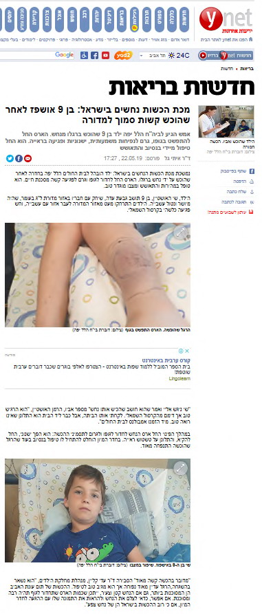 מכת הכשות נחשים בישראל: בן 9 אושפז לאחר שהוכש קשות סמוף למדורה