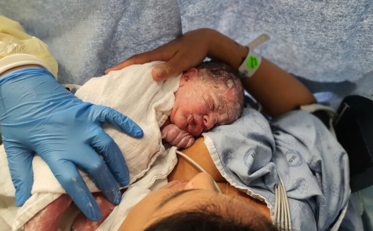 הכל על ניתוח קיסרי