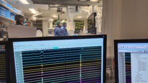 מערכת אבלציה חדשה במערך הלב